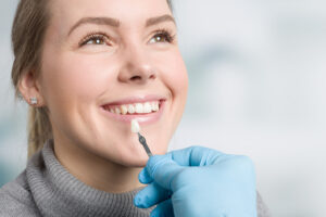 faccette dentali