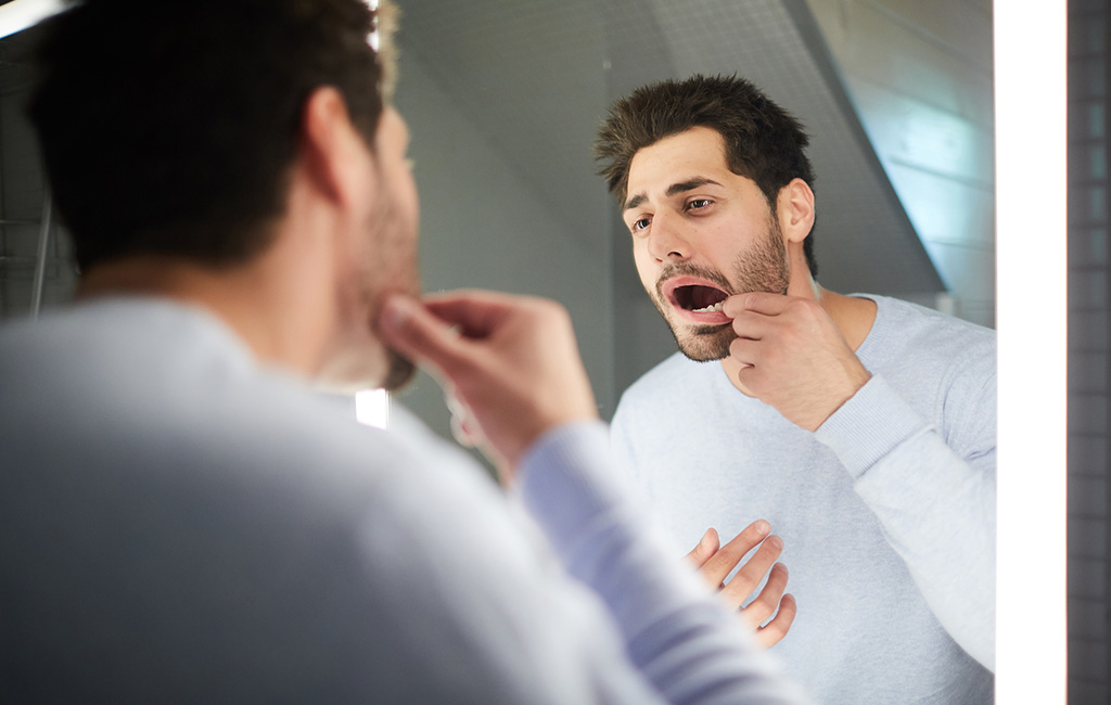 Denti consumati? Potrebbe essere erosione dentale