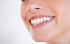 sbiancare i denti a casa