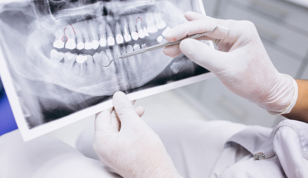 Implantologia Vicenza: soluzioni innovative per un sorriso perfetto